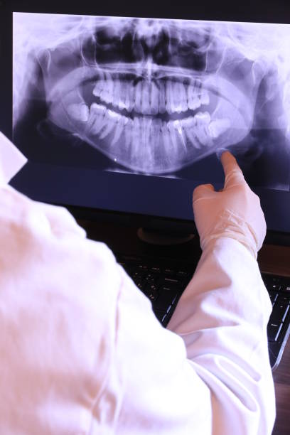 Best Emergency Root Canal Treatment in Spencer, WI